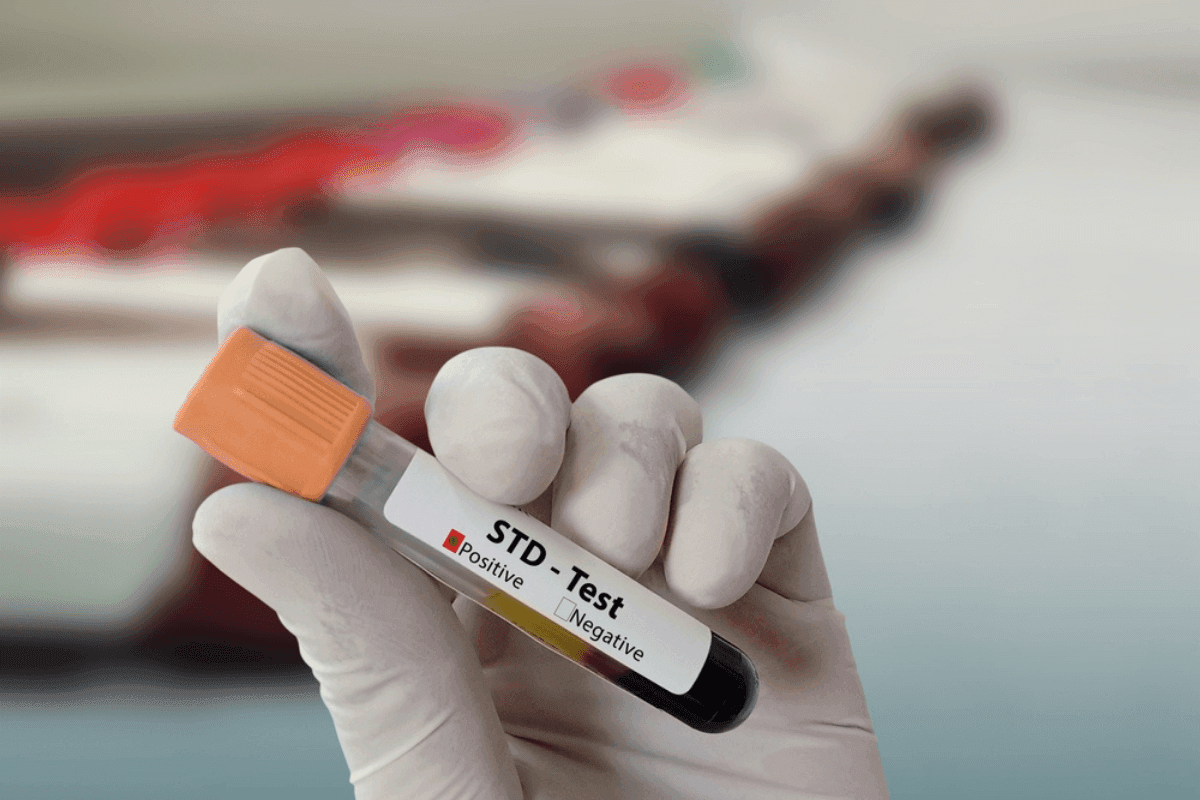 STD Test at Home Cost in Dubai: Complete 2026 Price Guide — Siza Health Care blog